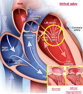 mitral-valve
